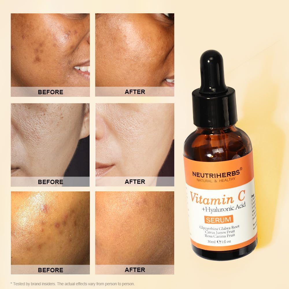 NEUTRIHERBS Vitamin C Serum for Face with Hyaluronic Acid, Firm, Anti Aging, Brighten, Even Skin, Daily Skincare Natural Nourish Facial Serum,1 fl oz