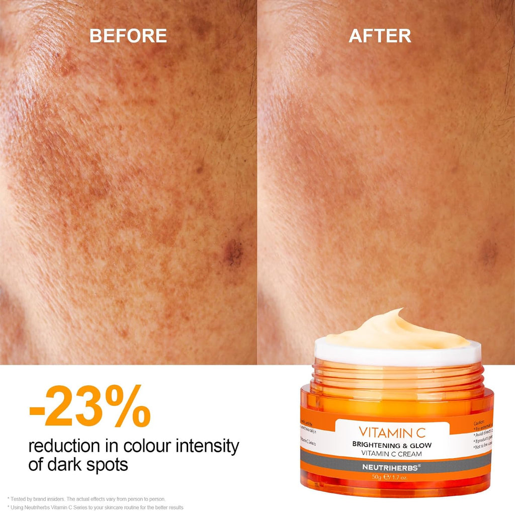 Neutriherbs Vitamin C Face Cream Day & Night Cream Facial Moisturizer - Moisturizing Softening & Smoothing Skin 1.7oz
